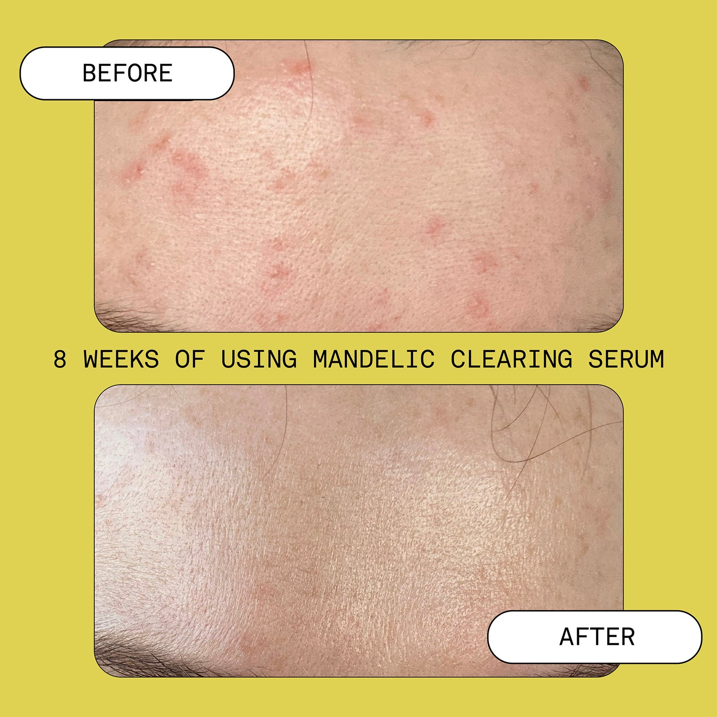 Mandelic Clearing Serum
