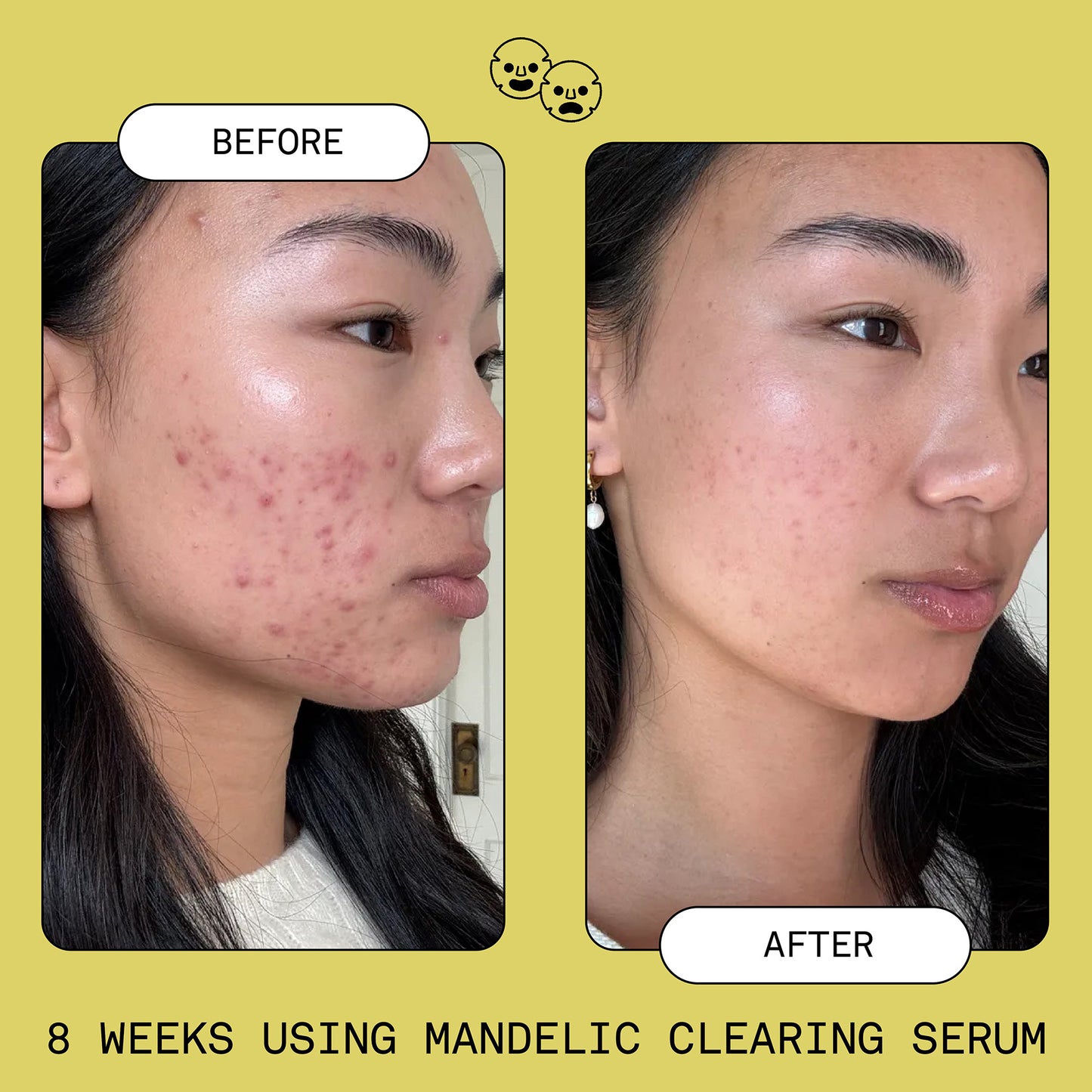 Mandelic Clearing Serum