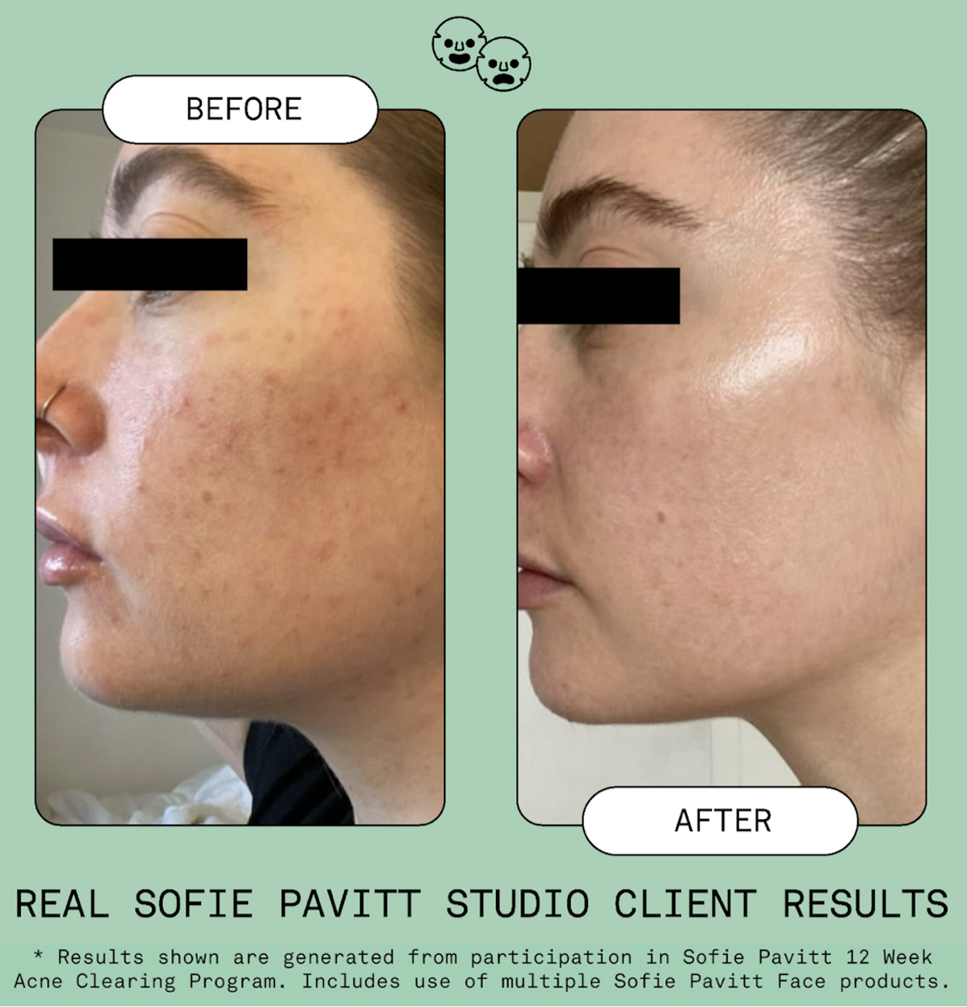 The Centre Handbag & Nice Ice