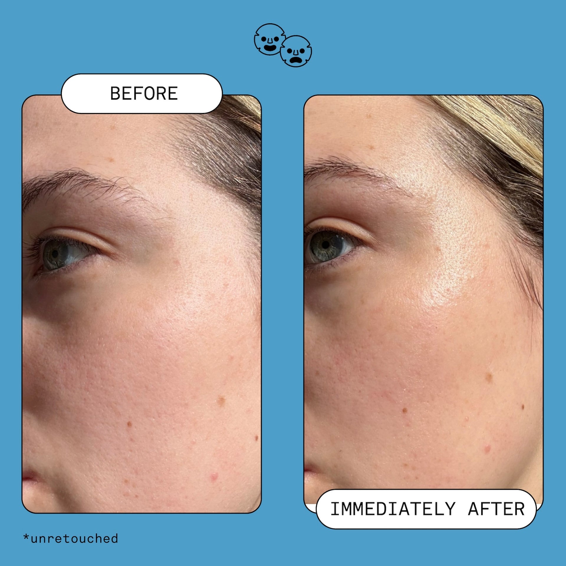 Omega Rich Moisturizer