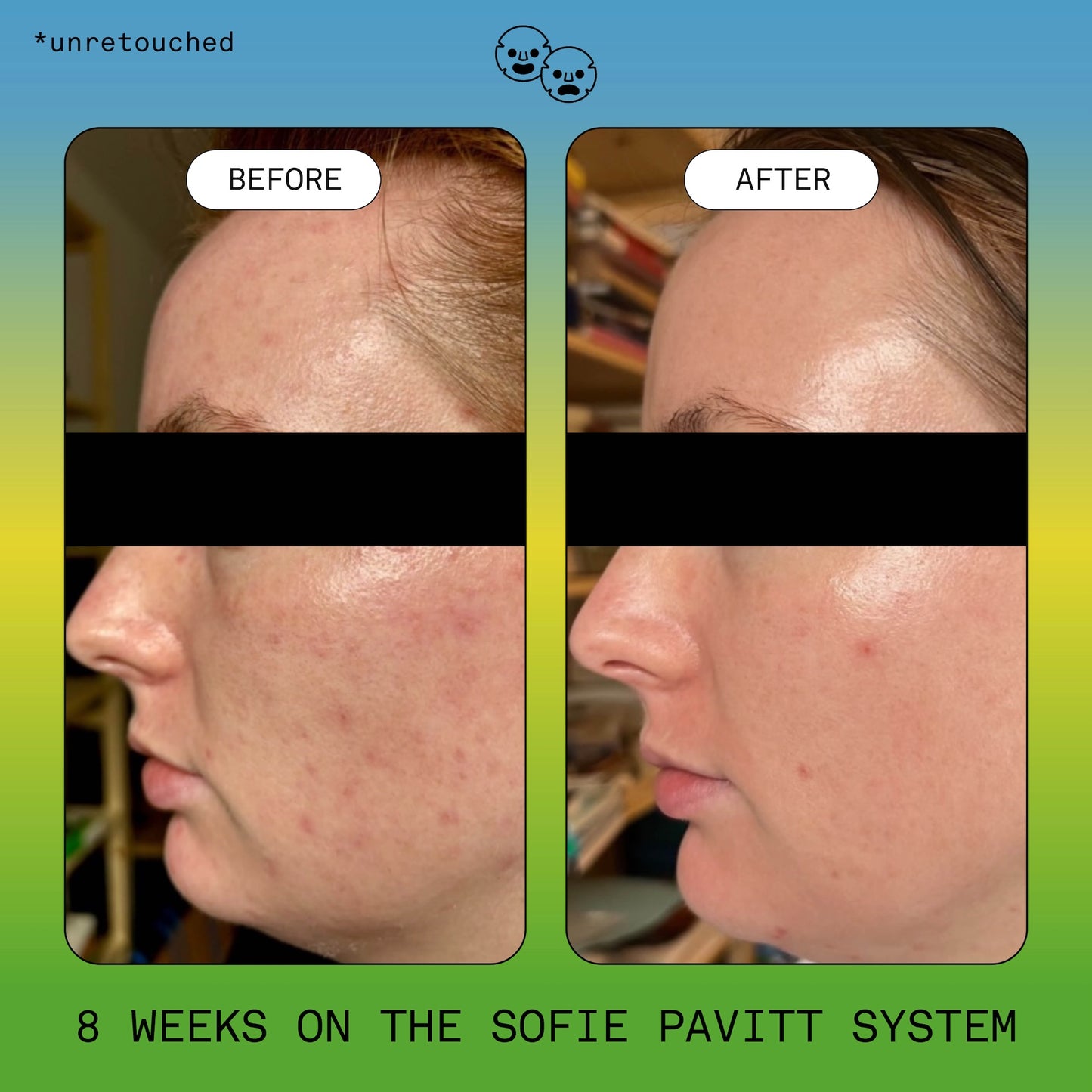 Skin School Trial Set: The System Minis