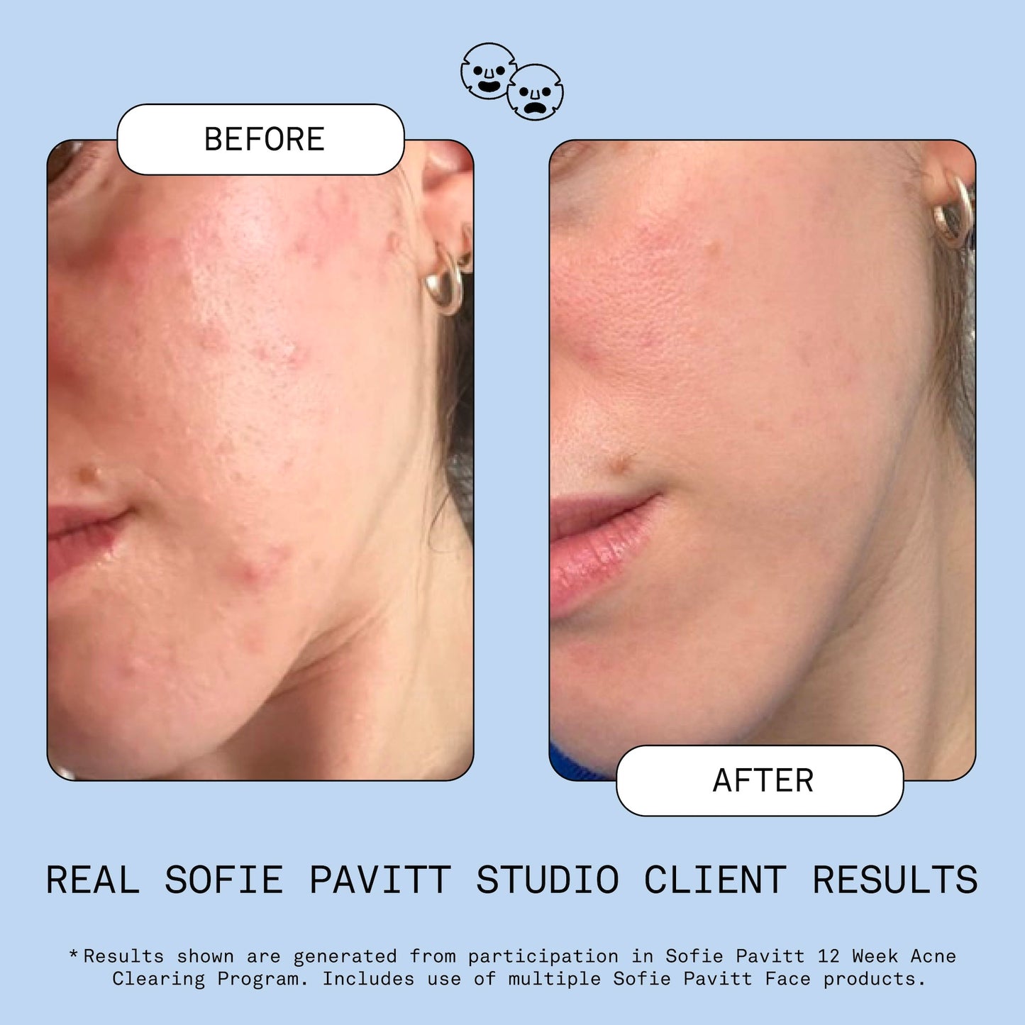Fridge to Face Blemish Defense Mist