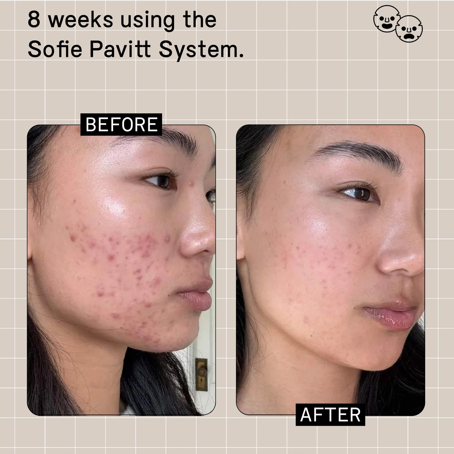 Limited Edition: The System Gift Set