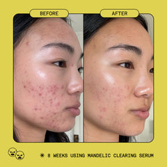 Mandelic Clearing Serum
