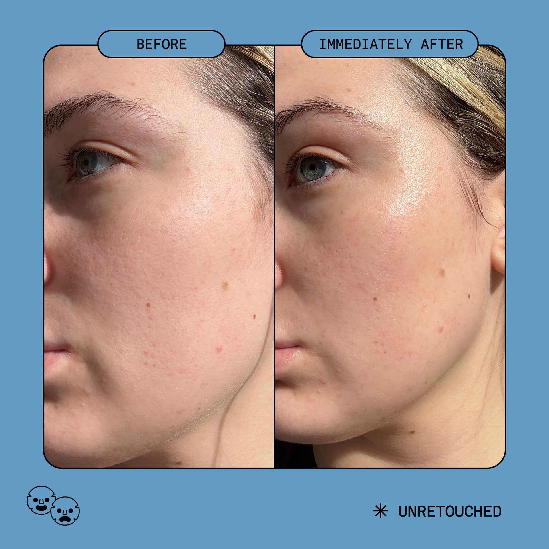 Omega Rich Moisturizer