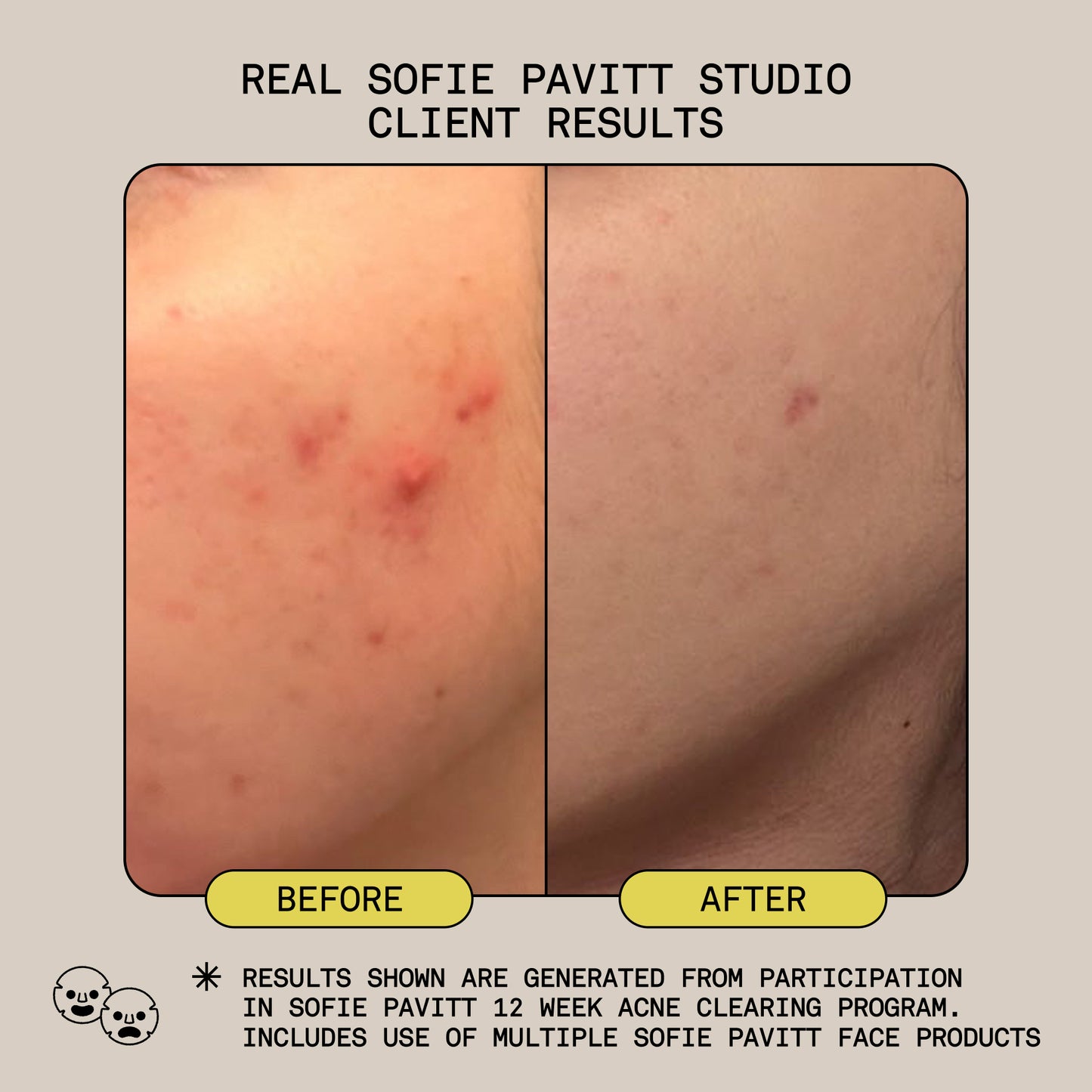 THE SYSTEM - Normal to Dry Skin