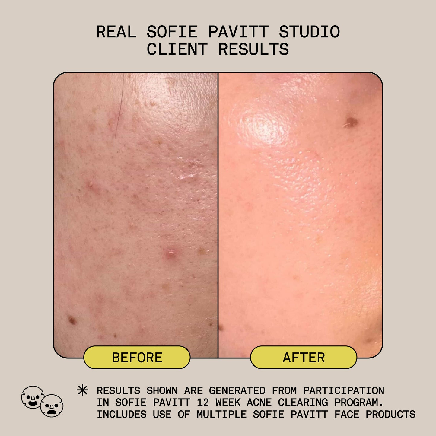 THE SYSTEM - Normal to Oily Skin