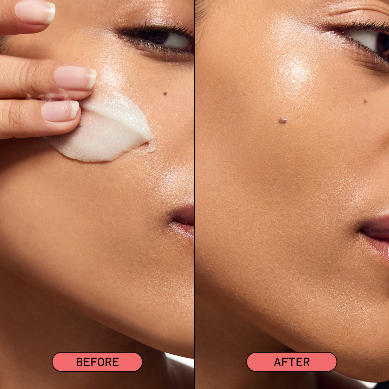 Studio-Smooth Microdermabrasion Treatment