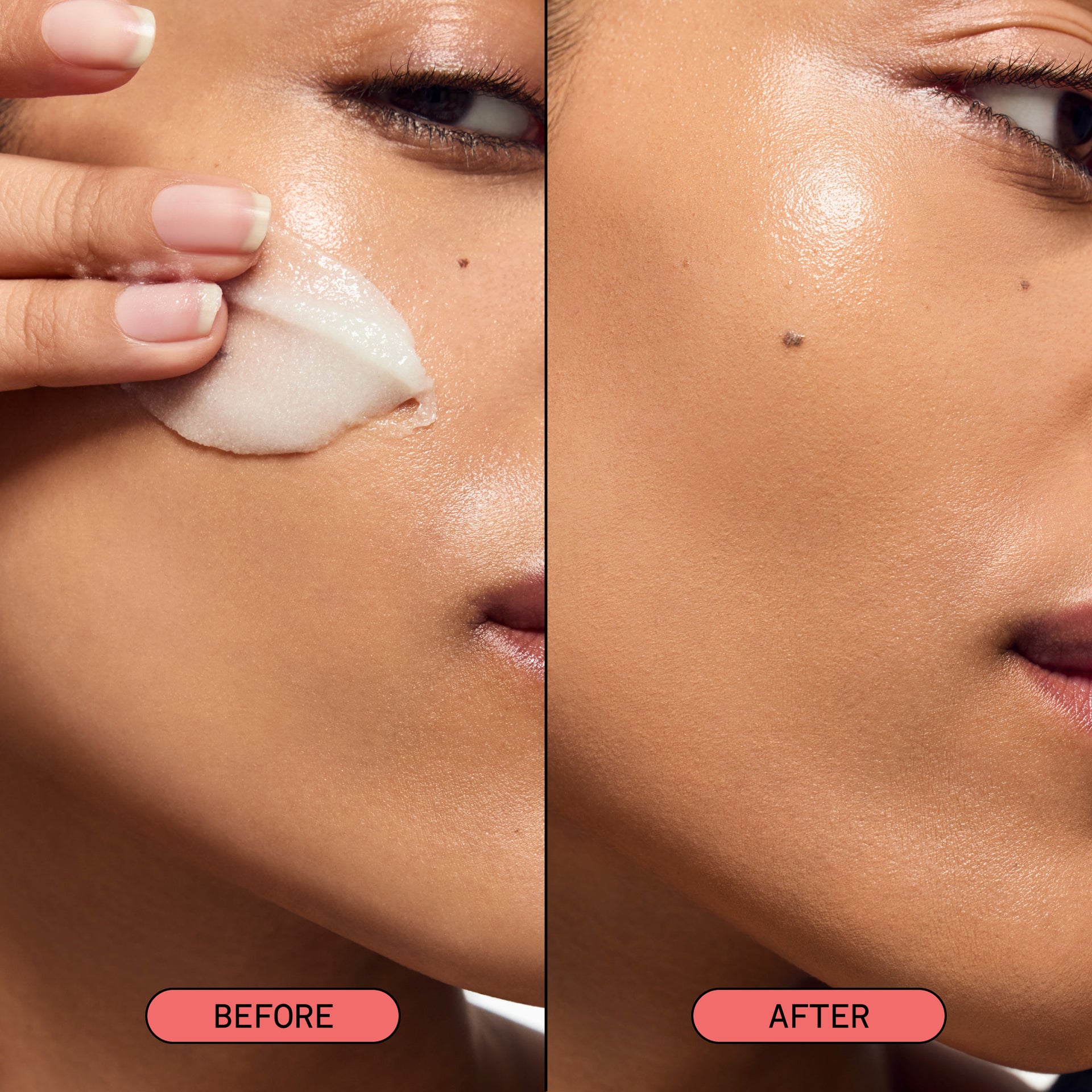Studio-Smooth Microdermabrasion Treatment