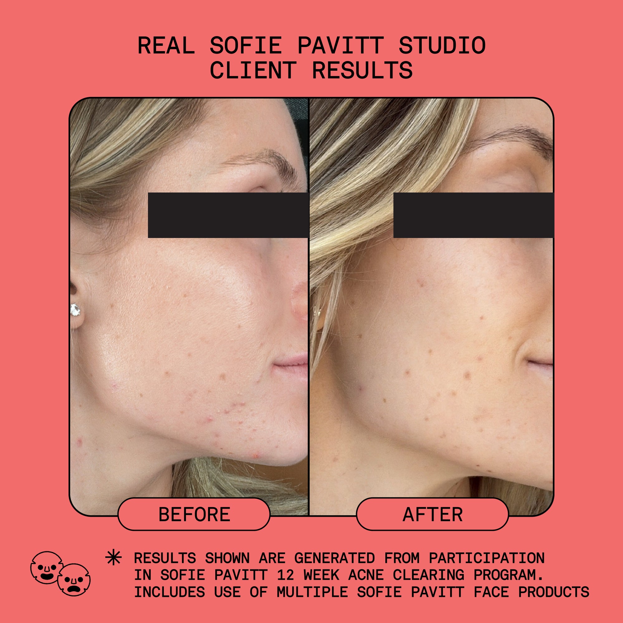 Studio-Smooth Microdermabrasion Treatment Scrub – Sofie Pavitt Face