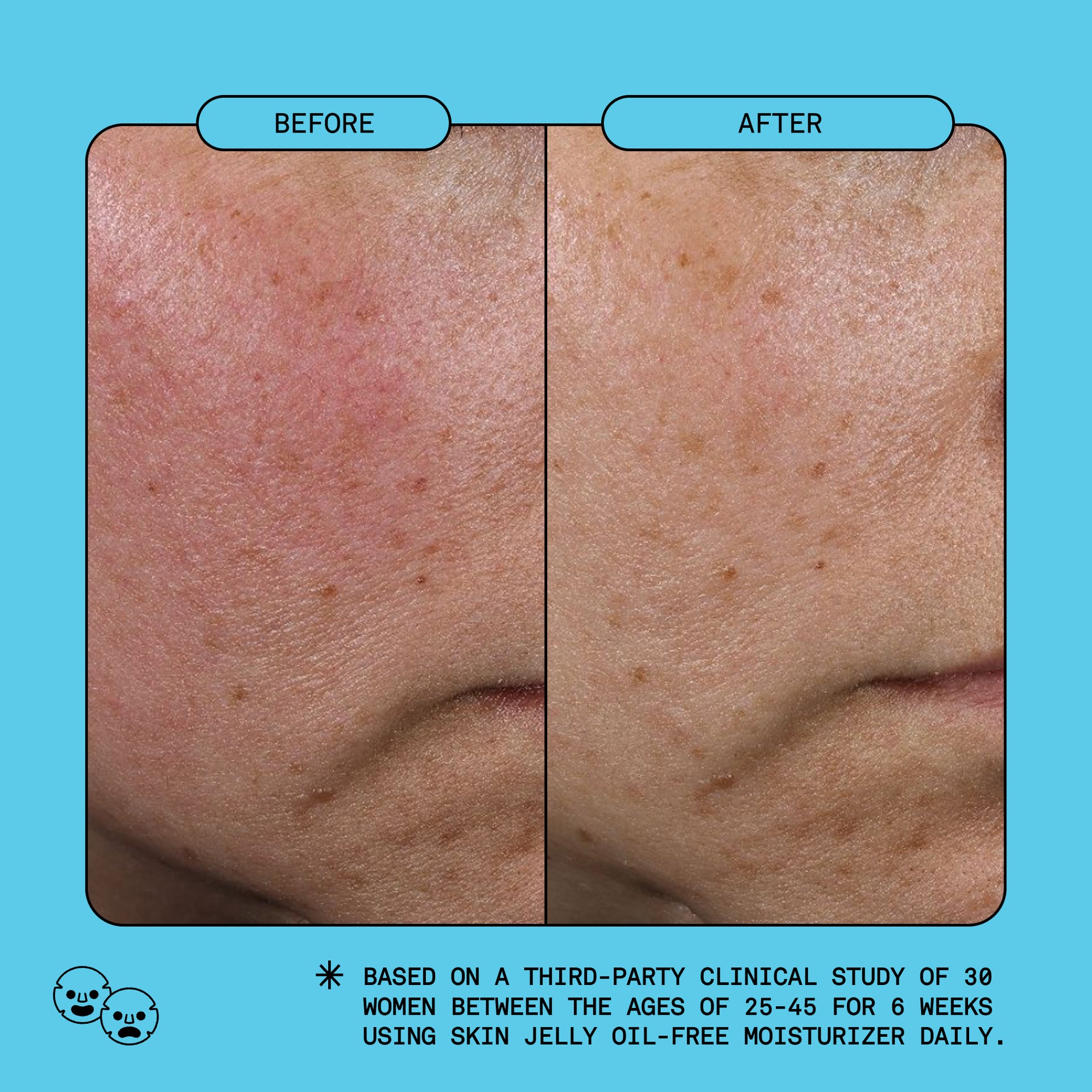 Skin Jelly Oil-Free Gel Moisturizer