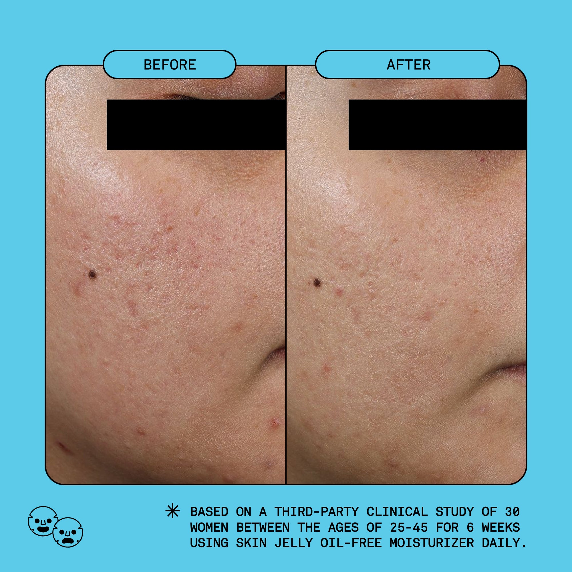Skin Jelly Oil-Free Gel Moisturizer – Sofie Pavitt Face