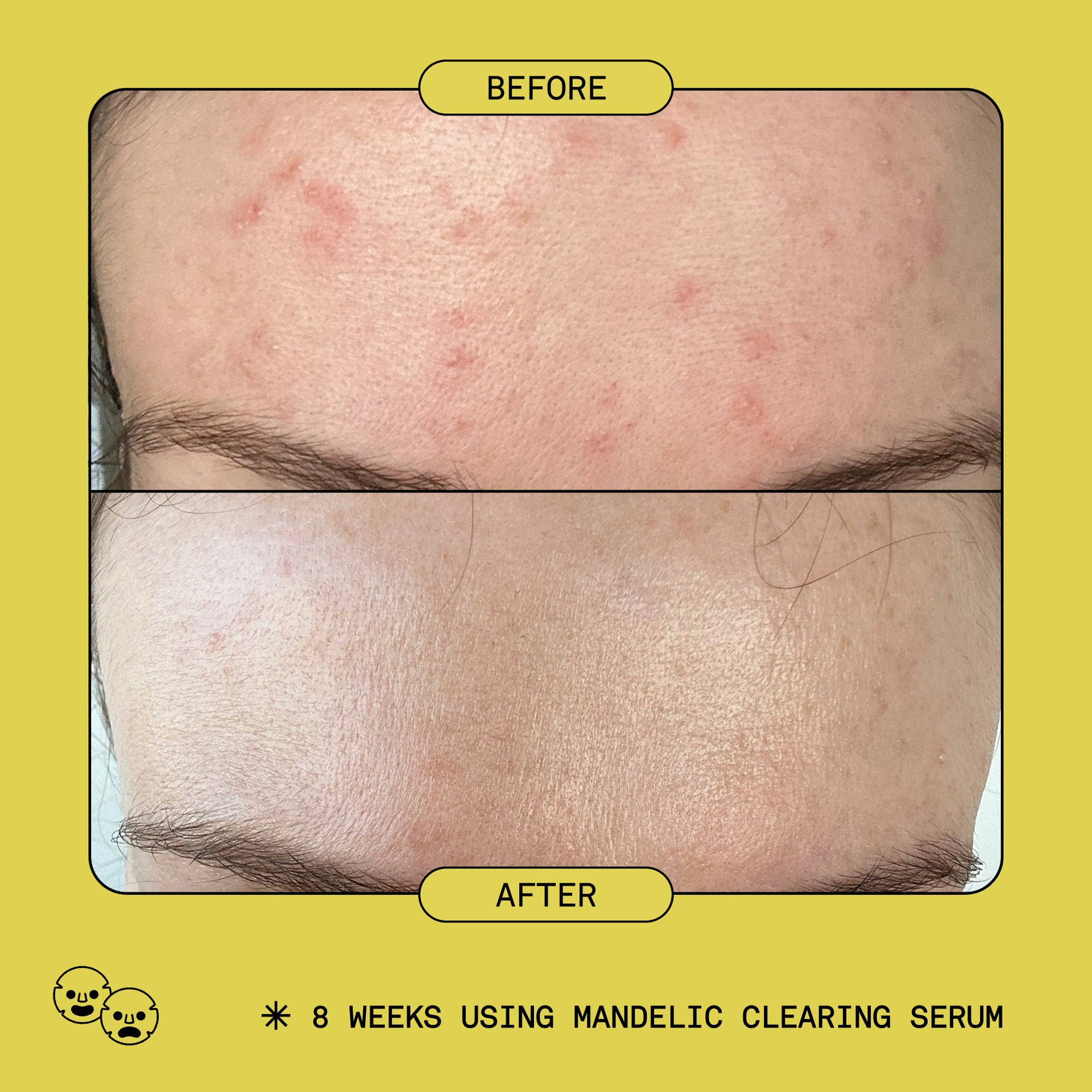JUMBO Mandelic Clearing Serum